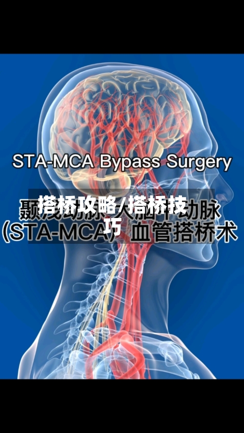 搭桥攻略/搭桥技巧-第1张图片
