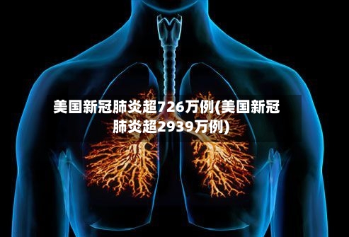 美国新冠肺炎超726万例(美国新冠肺炎超2939万例)