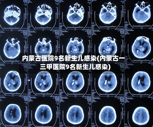 内蒙古医院9名新生儿感染(内蒙古一三甲医院9名新生儿感染)