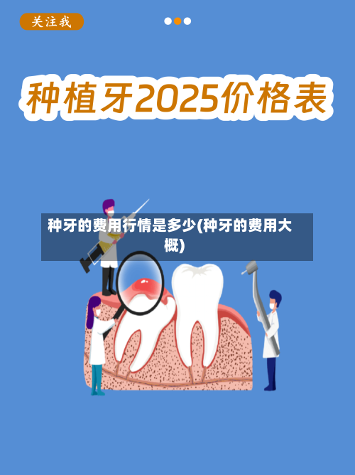 种牙的费用行情是多少(种牙的费用大概)-第1张图片