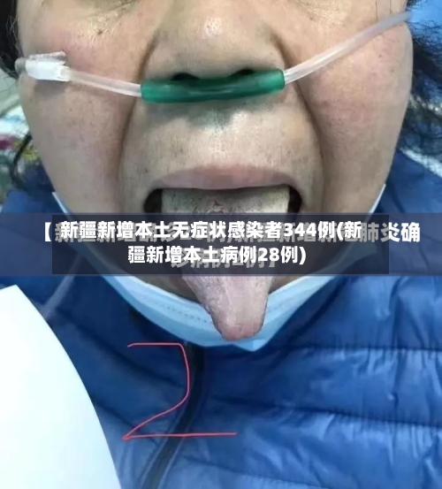 新疆新增本土无症状感染者344例(新疆新增本土病例28例)-第1张图片