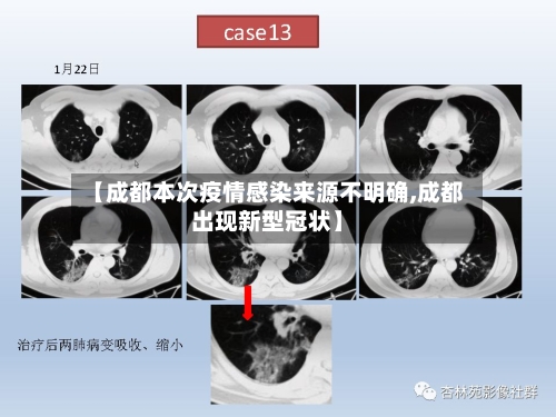 【成都本次疫情感染来源不明确,成都出现新型冠状】-第1张图片